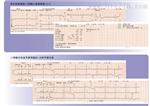 数字式心电图机价格 ECG-1150 光电数字式心电图机价格