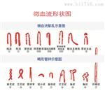 高清微循环检测仪